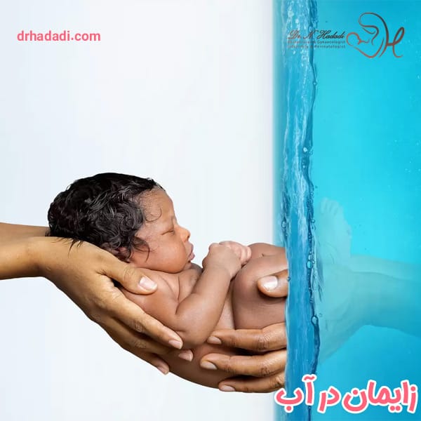 زایمان در آب - دکتر نگین حدادی