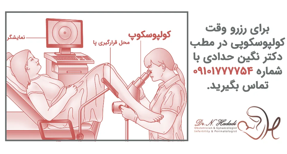 کولپوسکوپی رحم