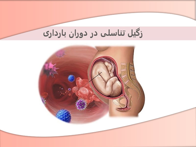 زگیل تناسلی در بارداری - دکتر نگین حدادی