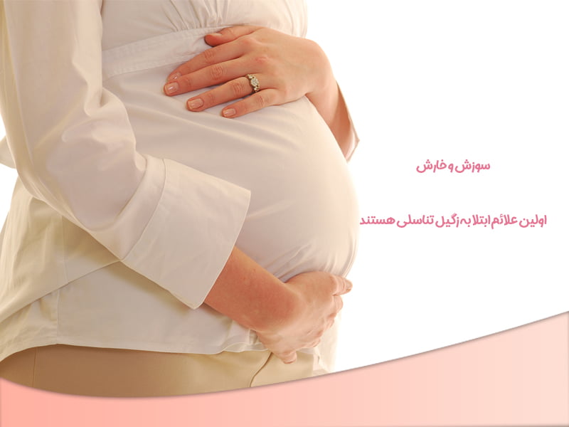 زگیل تناسلی در بارداری - دکتر حدادی