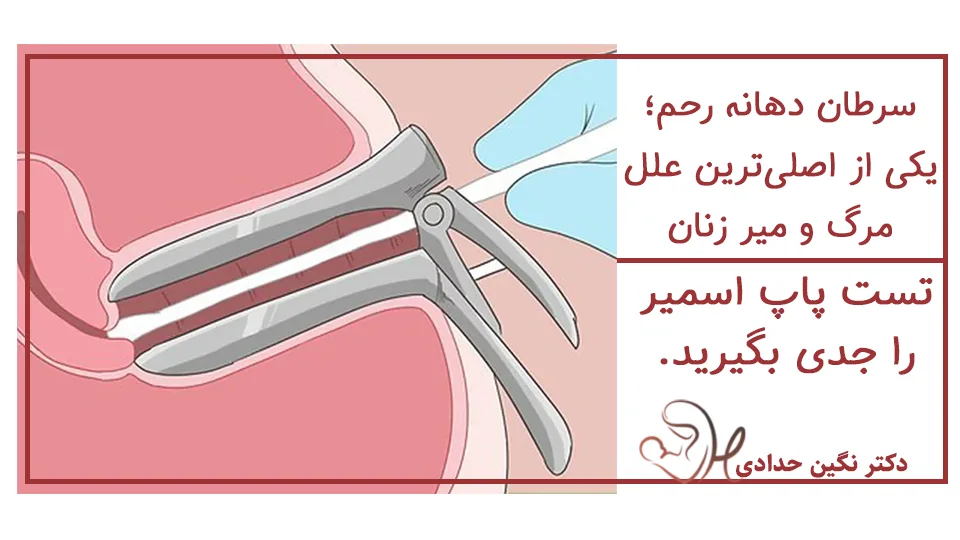 اهمیت تست پاپ اسمیر