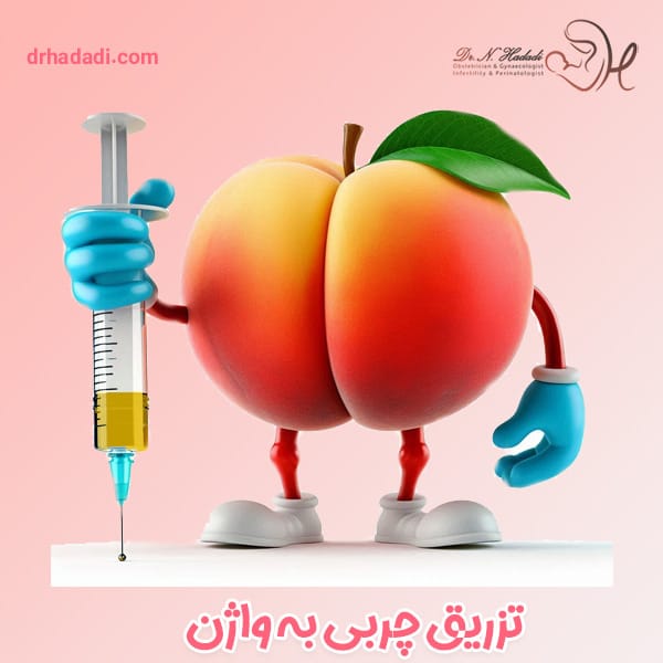 تزریق چربی به واژن - دکتر نگین حدادی