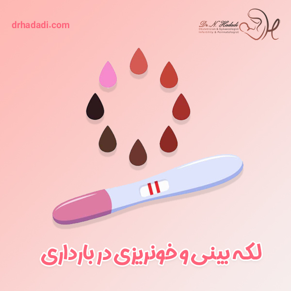 لکه بینی و خونریزی در بارداری - دکتر نگین حدادی