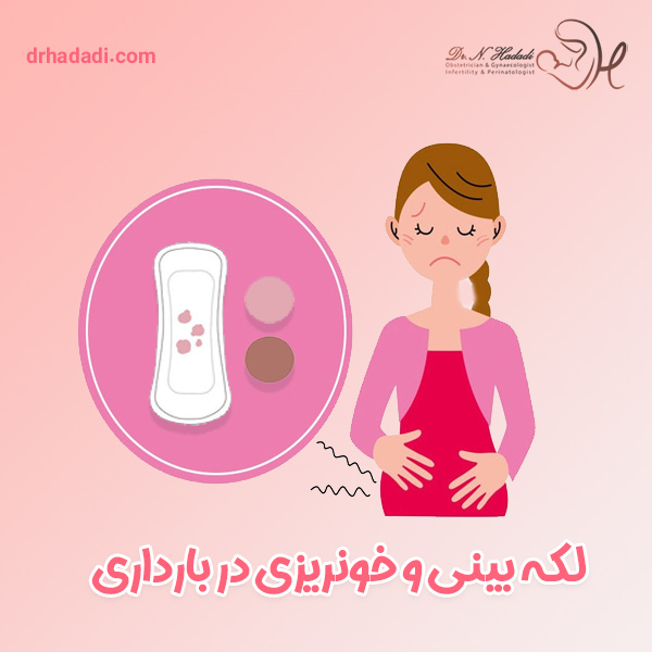 لکه بینی و خونریزی در بارداری - دکتر نگین حدادی