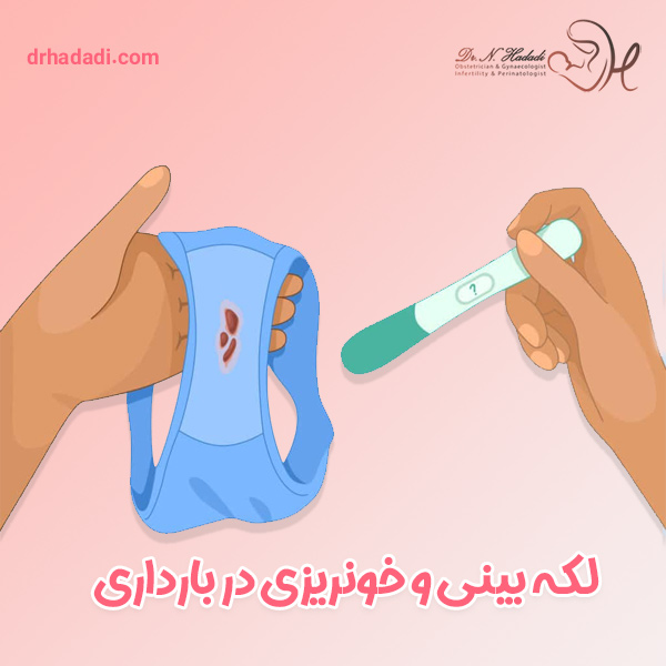 لکه بینی و خونریزی در دوران بارداری | نکات هشدار دهنده