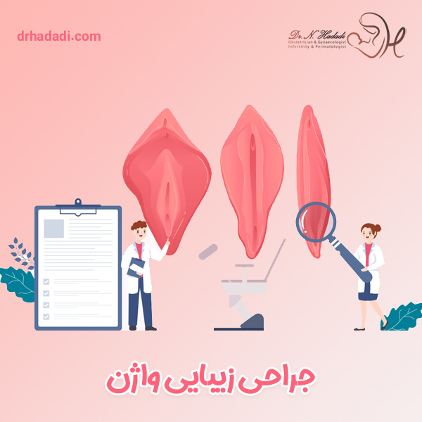 جراحی تنگ کردن - دکتر نگین حدادی