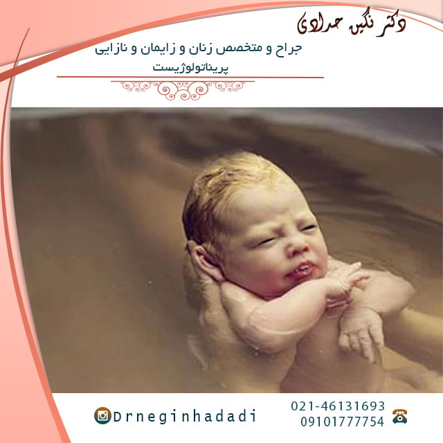 زایمان در آب - دکتر نگین حدادی