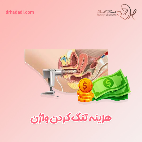 هزینه تنگ کردن واژن - دکتر نگین حدادی