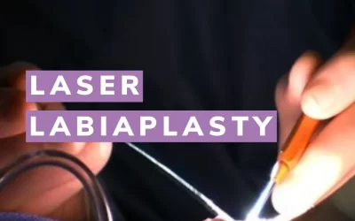 جراحی لابیاپلاستی با لیزر