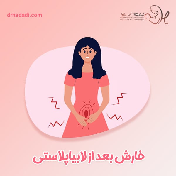 خارش بعد از لابیاپلاستی - دکتر نگین حدادی