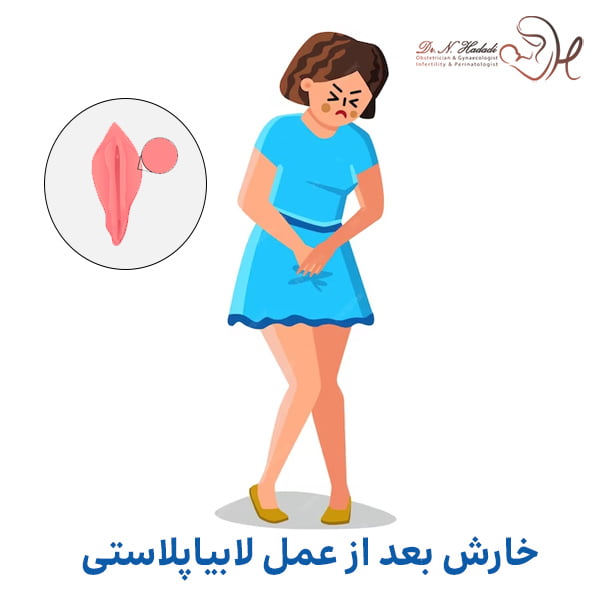 خارش بعد از عمل لابیاپلاستی - دکتر نگین حدادی