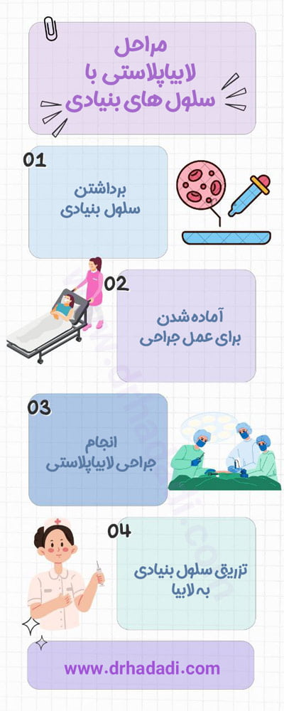 مراحل لابیاپلاستی با سلول های بنیادی - دکتر نگین حدادی