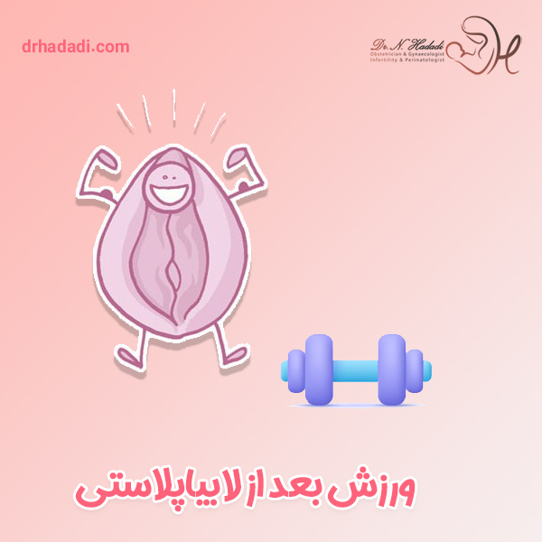 ورزش بعد از لابیاپلاستی - دکتر نگین حدادی