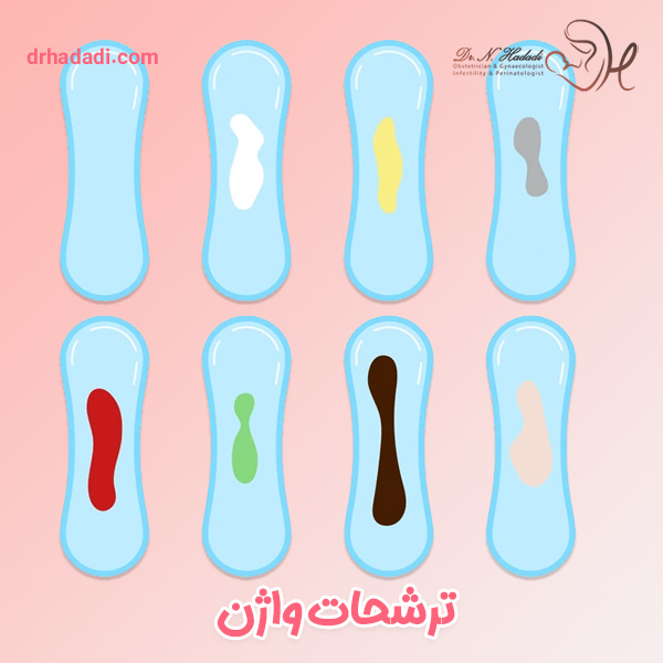 انواع ترشحات واژن - دکتر نگین حدادی