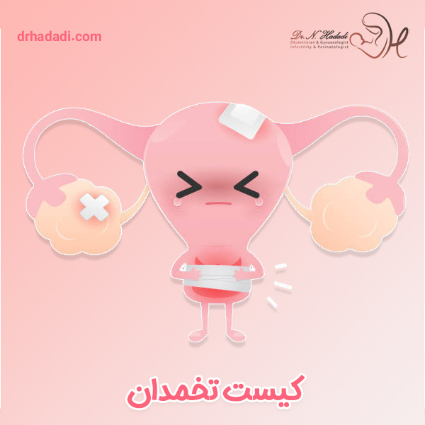 چه اندازه کیست تخمدان خطرناک است ؟