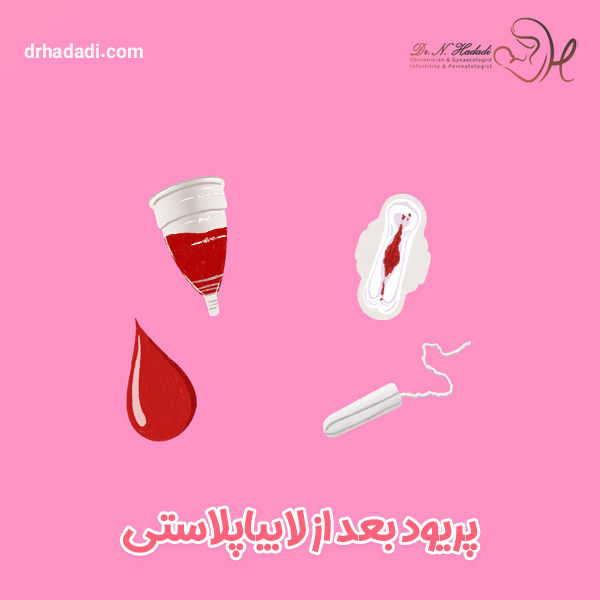 پریود بعد از لابیاپلاستی - دکتر نگین حدادی