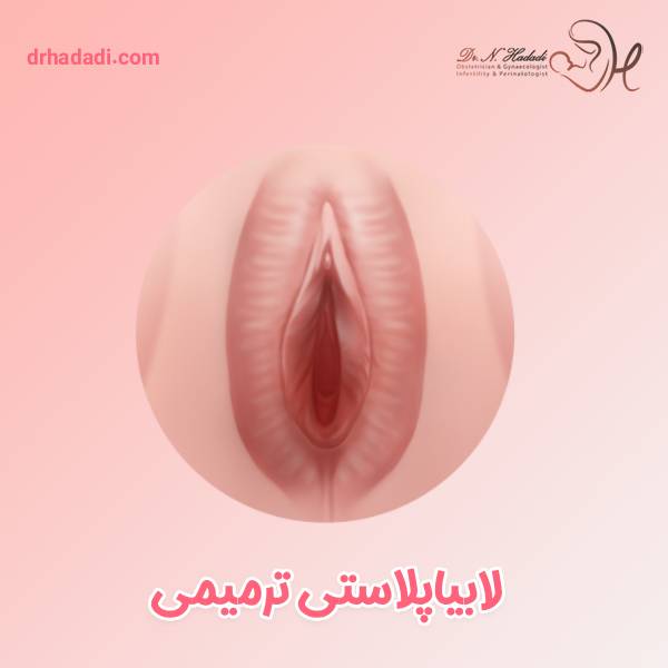 عمل لابیاپلاستی ترمیمی با چه اهدافی انجام می شود ؟