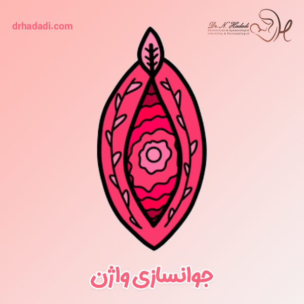 جوانسازی واژن - دکتر نگین حدادی