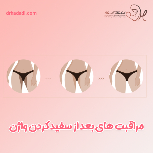 مراقبت های بعد از سفید کردن واژن - دکتر نگین حدادی