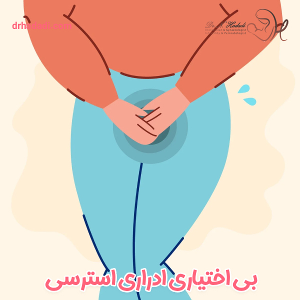 بی اختیاری ادراری استرسی - دکتر نگین حدادی