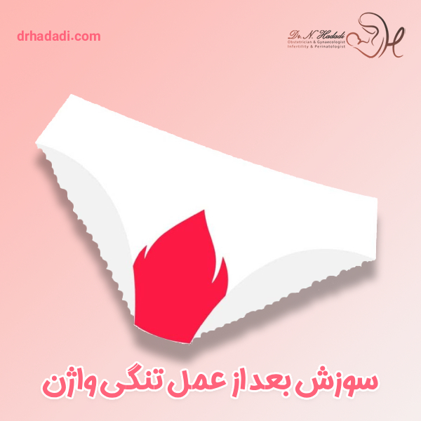 سوزش بعد از عمل تنگی واژن - دکتر نگین حدادی