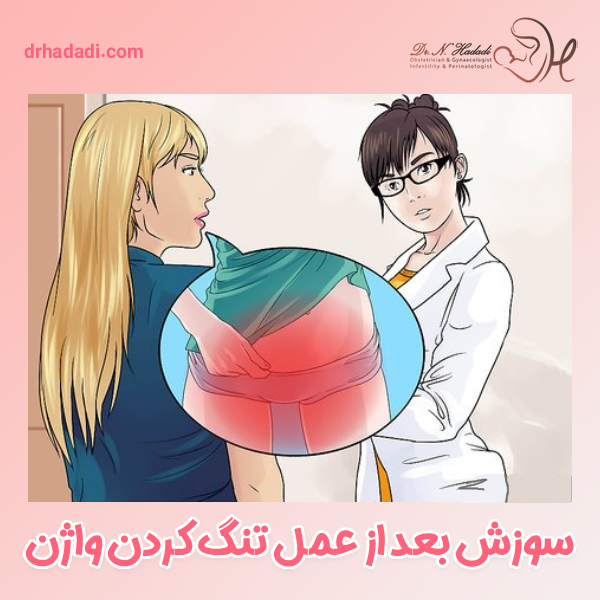 سوزش واژن بعد از عمل تنگ کردن واژن