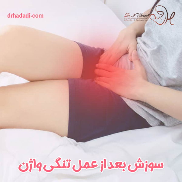 سوزش بعد از عمل تنگی واژن - دکتر نگین حدادی
