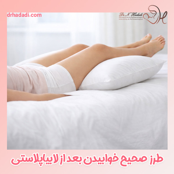 خوابیدن بعد از لابیاپلاستی