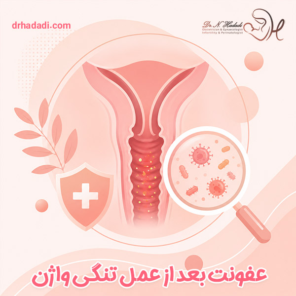عفونت بعد از عمل تنگی واژن | علائم ، علت ها و روش درمان